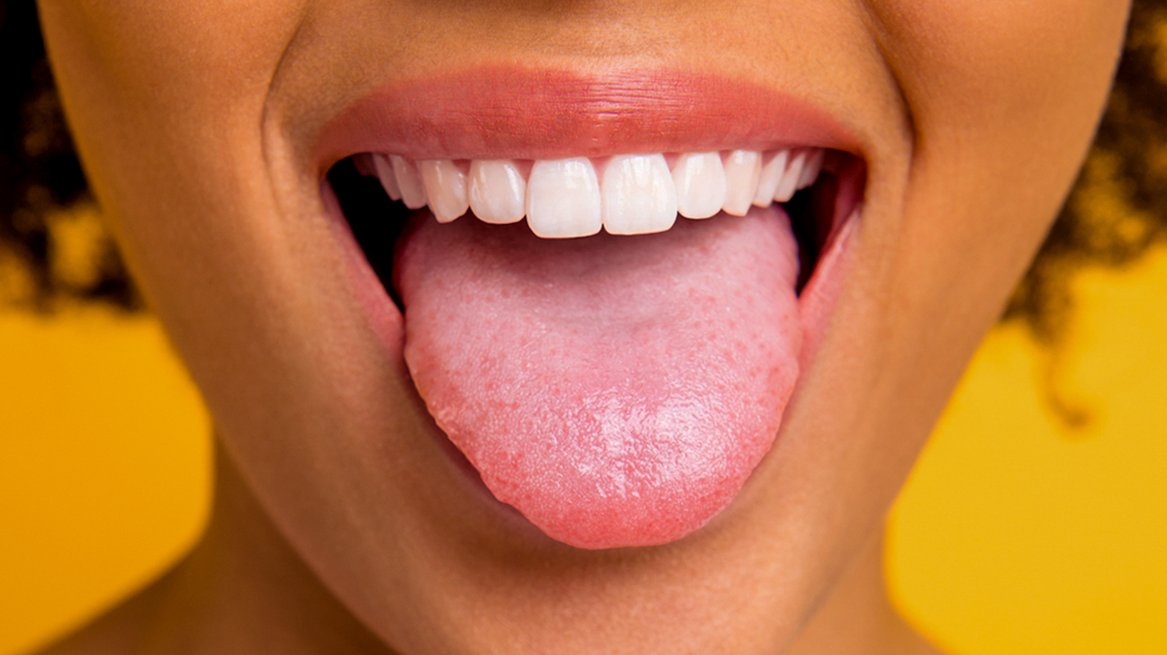 Tongue Signs Of Health Problems - Get Clues About Your Health Through This Strong Muscle
